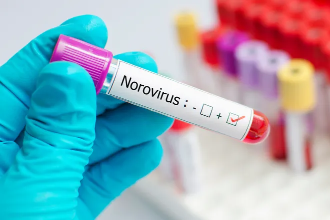 The CDC Reports a rise in Cases of Norovirus: Information Regarding the Stomach Flu